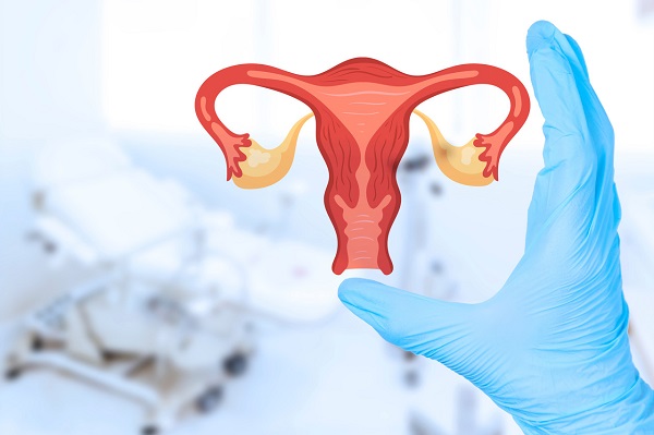 子宫切除的女性